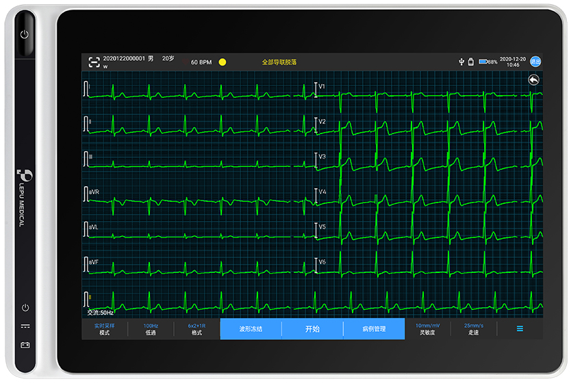 平板心电图机T120