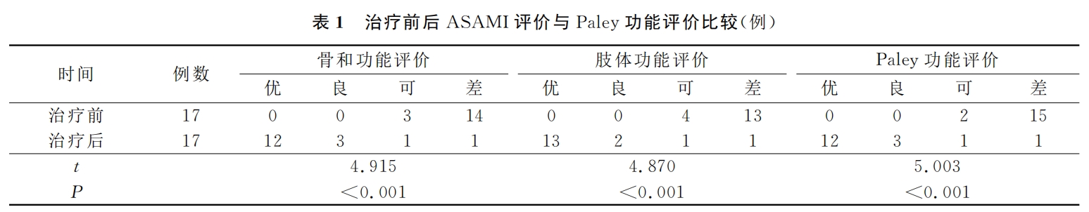 骨搬移术后对接端不愈合的治疗新手段